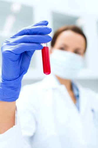 female pathologists analysing blood test samples of a patient wearing blue gloves